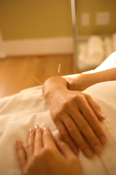 5 Things to Know About the Safety of Acupuncture During ...